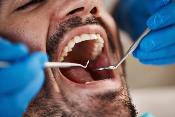 Best Emergency Tooth Extraction in South Barrington, IL