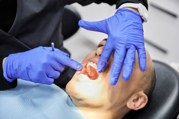 Best Emergency Tooth Extraction in South Barrington, IL