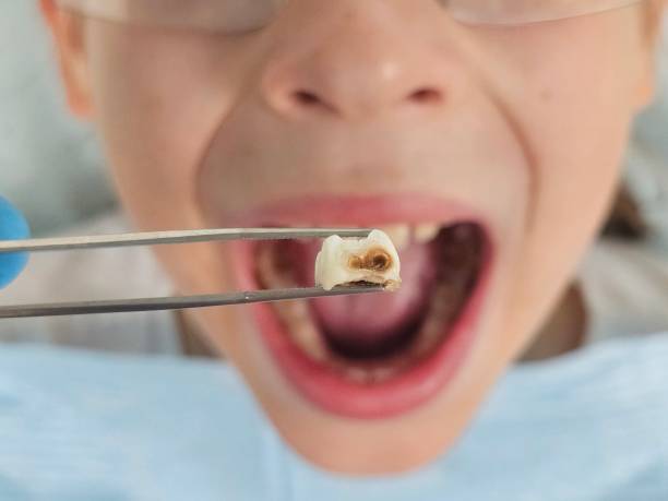 Best Emergency Gum Treatment in South Barrington, IL