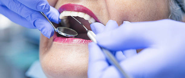 Best Emergency Wisdom Teeth Removal in South Barrington, IL